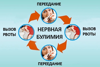 Лечение булимии в Нязепетровске